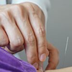 Brasil regulamenta exercício profissional da acupuntura