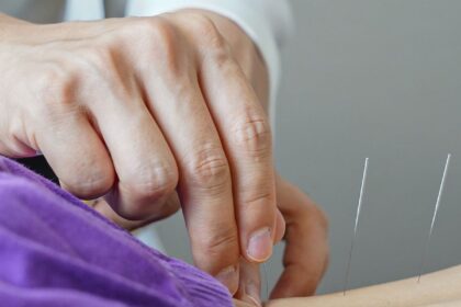 Brasil regulamenta exercício profissional da acupuntura