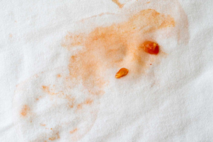 Mancha de molho no guardanapo? Veja como remover sem esforço